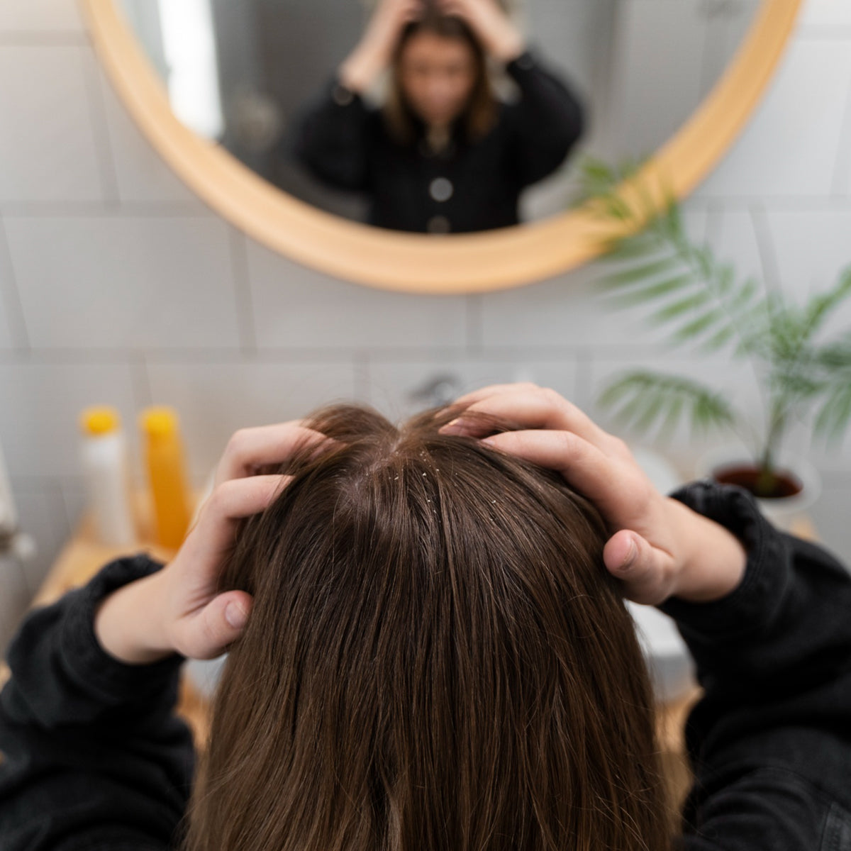 Japanese Dandruff Solutions for a Flake-Free Scalp